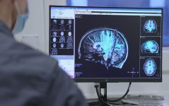 Beeld MRI hersenactiviteit.jpg Beeld MRI hersenactiviteit.jpg